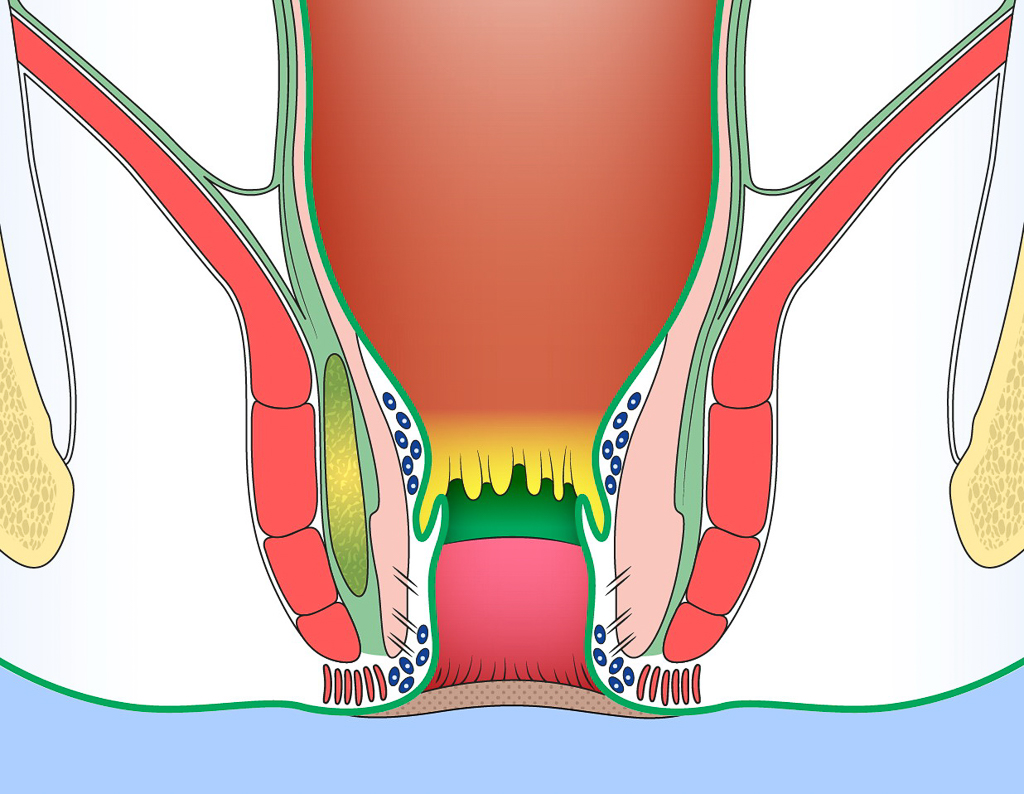 Ano-rectal