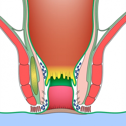 Ano-rectal
